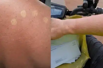 Australia Post Halts Uniform Rollout Over Sunburn Complaints