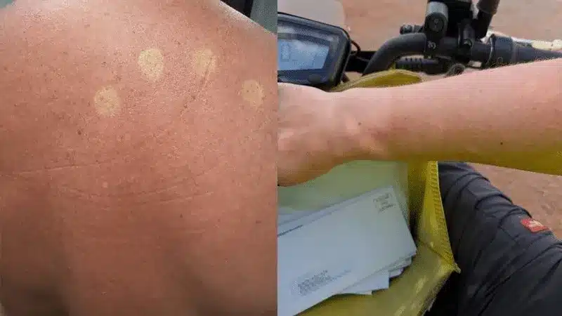 Australia Post Halts Uniform Rollout Over Sunburn Complaints Australia Post Halts Uniform Rollout Over Sunburn Complaints