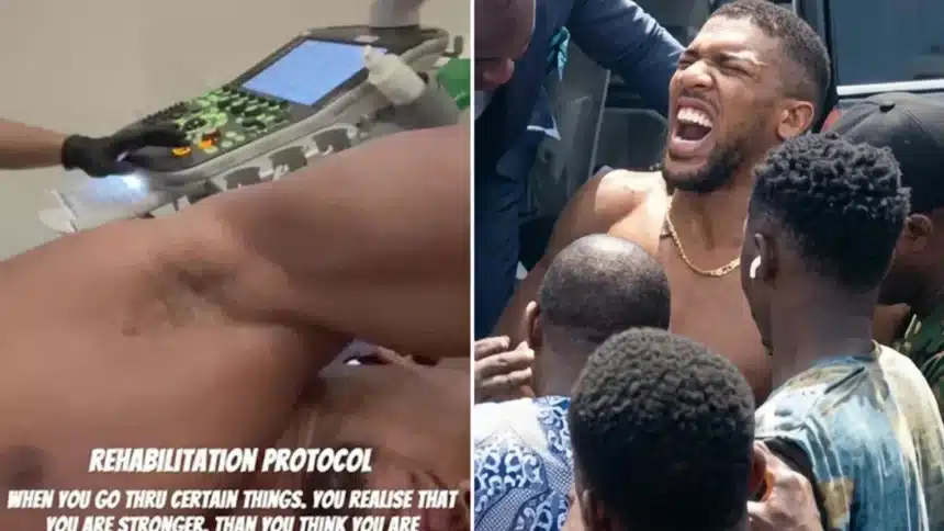 Anthony Joshua Advances Rib Rehab After Fatal Nigeria Crash Anthony Joshua Advances Rib Rehab After Fatal Nigeria Crash