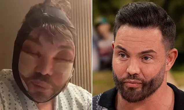 Bobby Norris Battles Insomnia After Facial Cosmetic Surgery