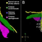 First Clitoris Nerve Map Reveals Vastly More Sensitivity