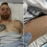 Speedway Star Tobias Thomsen Breaks Leg, Ribs in Shocking Crash