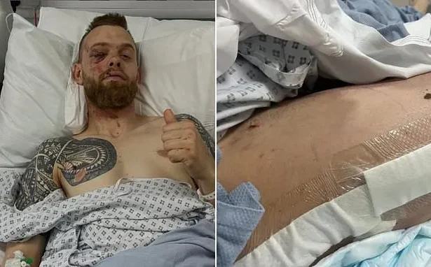 Speedway Star Tobias Thomsen Breaks Leg, Ribs in Shocking Crash