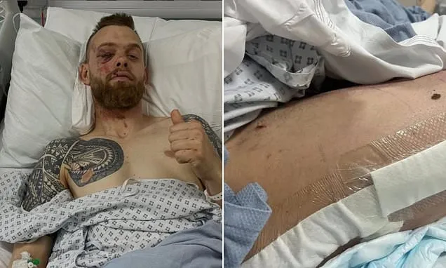 Speedway Star Tobias Thomsen Breaks Leg, Ribs in Shocking Crash