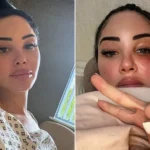 Tulisa Reveals Bell’s Palsy Attack, Cancels Egg Retrieval in Health Update