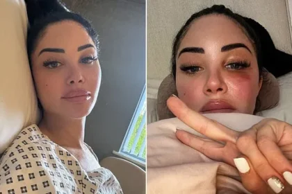 Tulisa Reveals Bell’s Palsy Attack, Cancels Egg Retrieval in Health Update