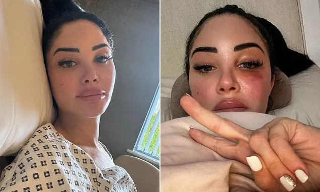 Tulisa Reveals Bell’s Palsy Attack, Cancels Egg Retrieval in Health Update
