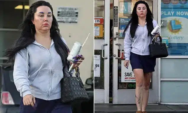 Amanda Bynes Flaunts 30lb Ozempic Loss and Bold Hair Change After Single Drop