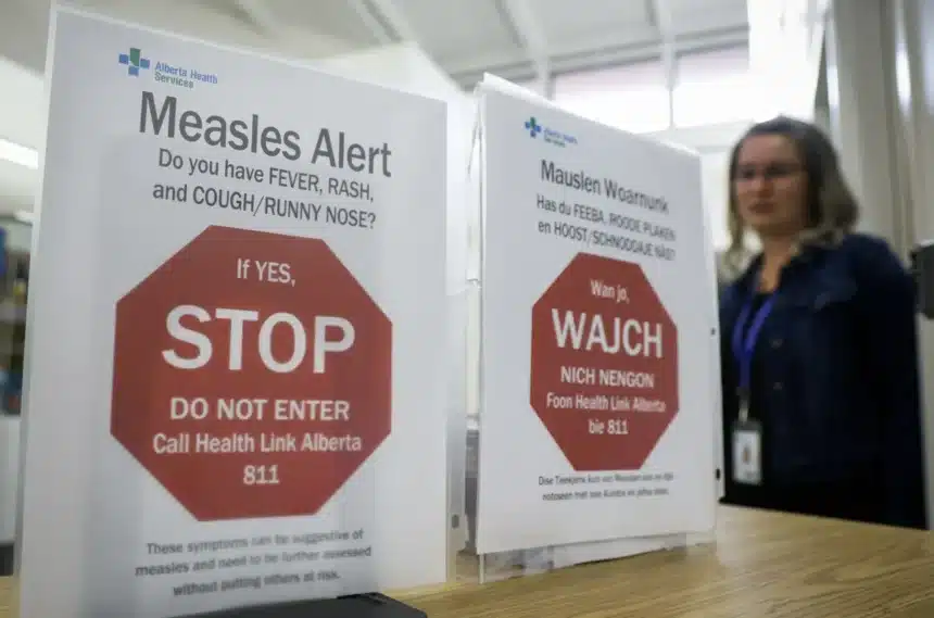 US Ends Largest Measles Outbreak; Canada Hits 900+ Cases