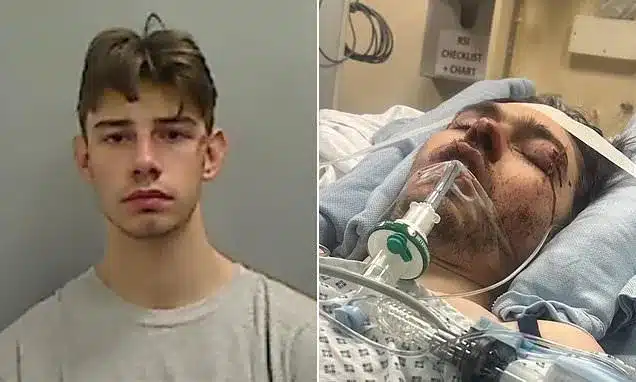 Drunk Rider’s Hit-and-Run Leaves Teen with Life-Altering Injuries Drunk Rider’s Hit-and-Run Leaves Teen with Life-Altering Injuries