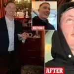 Microneedling Mishap: Man’s First Date Ruined by Red Face