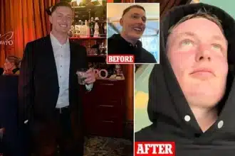 Microneedling Mishap: Man’s First Date Ruined by Red Face