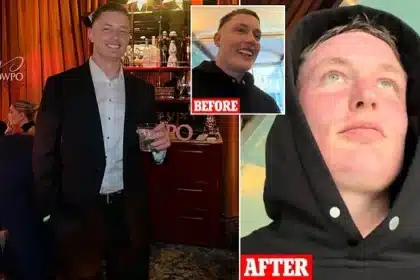 Microneedling Mishap: Man’s First Date Ruined by Red Face