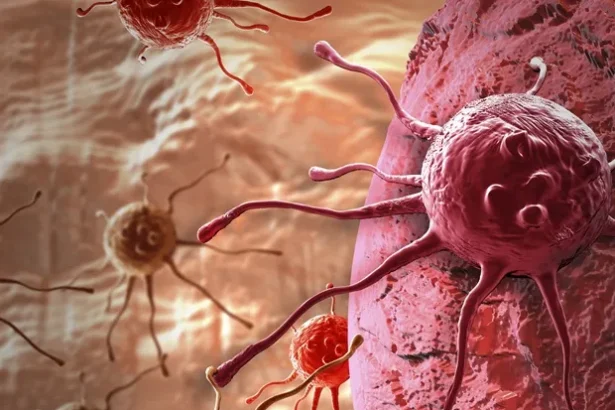 New Protein MRI Agent Detects Early Lung Cancer Metastases