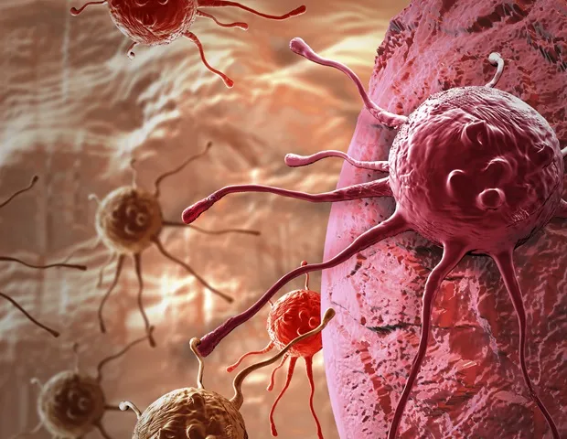 New Protein MRI Agent Detects Early Lung Cancer Metastases New Protein MRI Agent Detects Early Lung Cancer Metastases